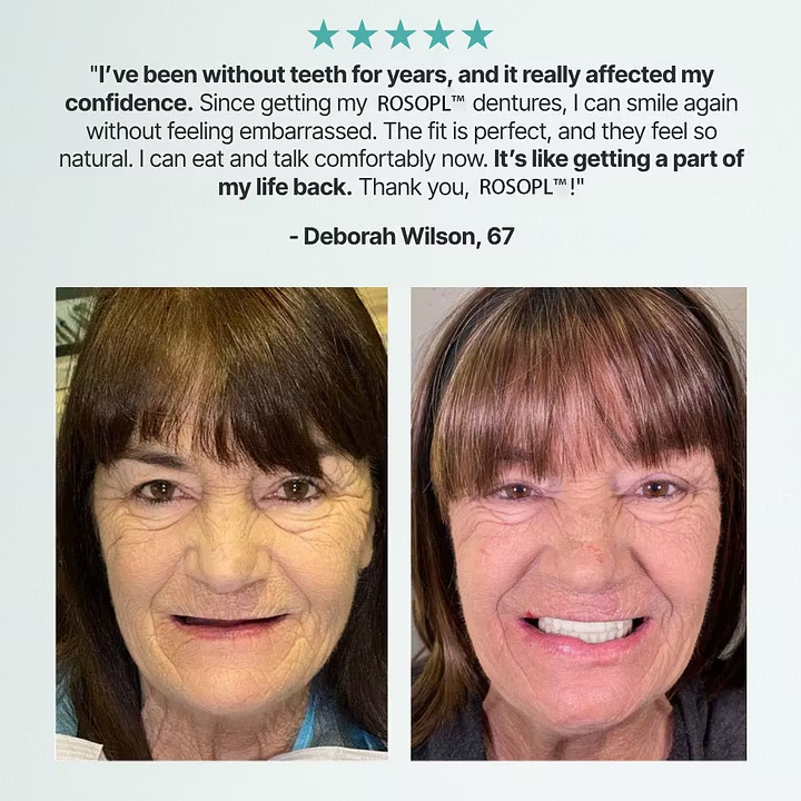 perrevia®Custom-Fit Dentures ⏰ ENDS TODAY • 70% OFF | Smile with Confidence